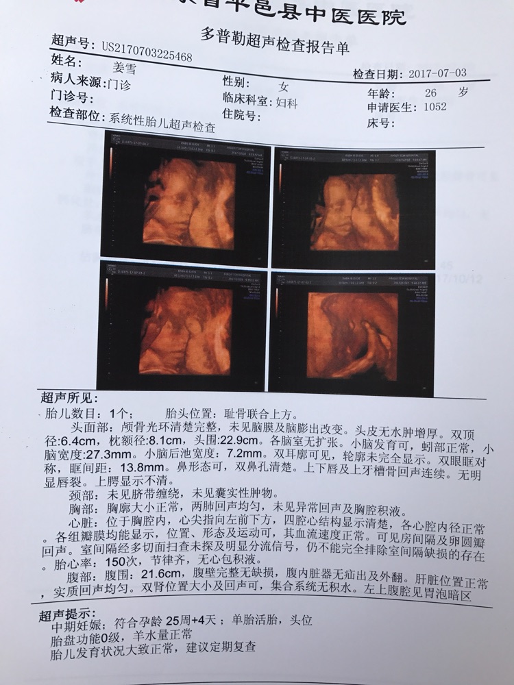 胎心率150是男孩還是女孩?解讀胎兒性別的真相,揭秘胎心率與胎兒性別之謎,胎心率150是男孩還是女孩?