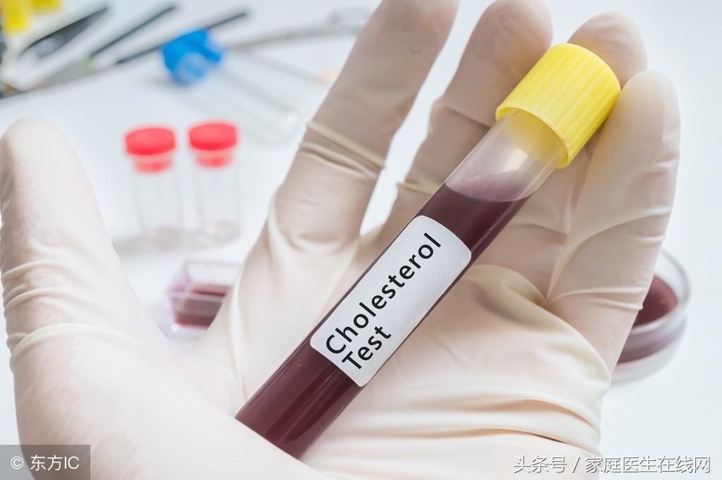 糖尿病的成因，深度解析其背后的原因，深度解析糖尿病成因，揭示背后原因真相