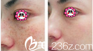 激光祛斑,選擇醫院還是美容院?全面解讀助您做出明智決策,激光祛斑,如何選擇醫院與美容院?全面解讀為您指明決策方向