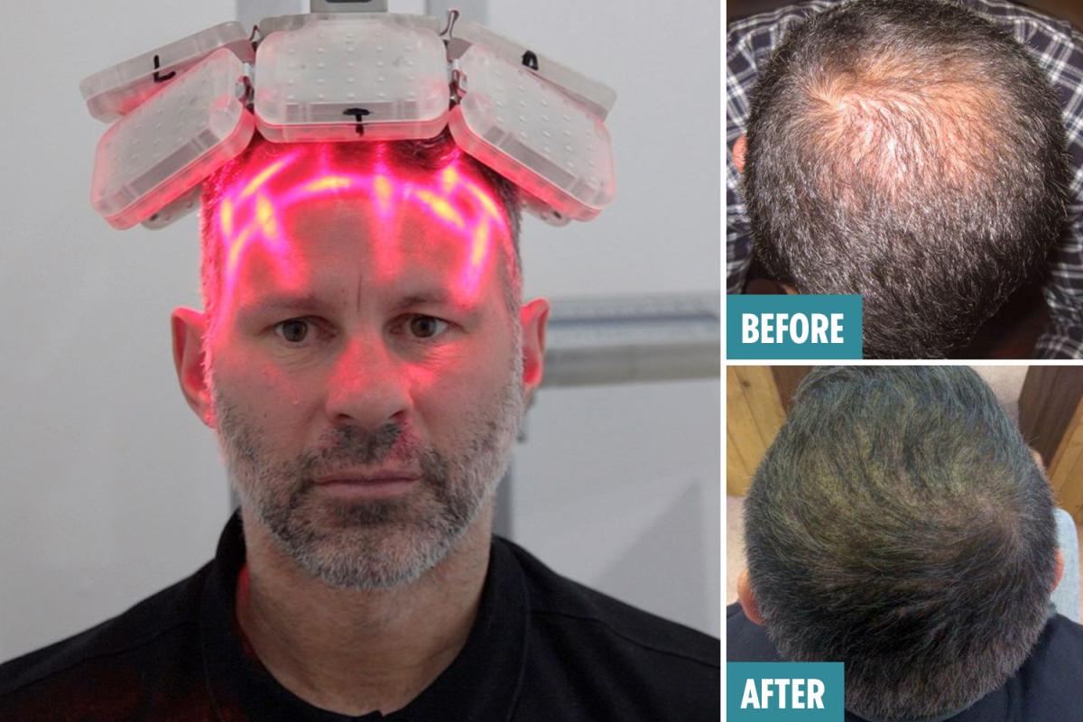 激光手術費用詳解,多少錢一次?,激光手術費用全面解析,手術費用究竟是多少?