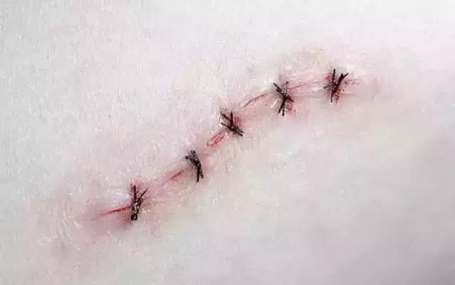 皮膚擦破皮了最快恢復方法不留疤——專業指南與實用建議，皮膚擦傷快速恢復不留疤，專業指南與實用建議