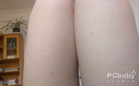 去除雞皮膚的小妙招,讓你的肌膚煥發(fā)自然光彩,雞皮膚改善秘訣,輕松告別不光滑,肌膚煥發(fā)自然光彩小妙招