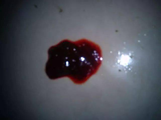 排便時出現撕裂感及出血，原因與應對措施，排便疼痛撕裂感及出血，原因分析及應對方法