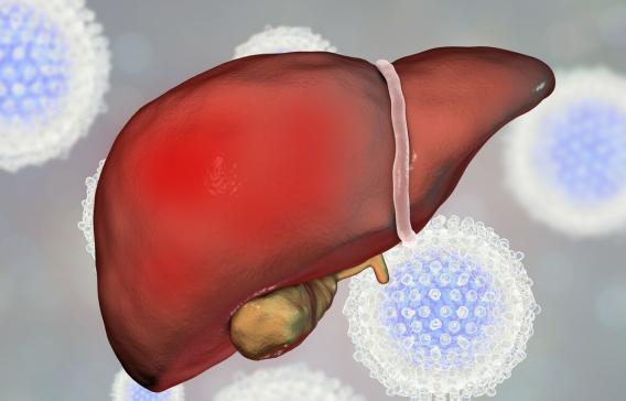 肝硬化的癥狀及表現(xiàn),肝硬化的癥狀與表現(xiàn)概述