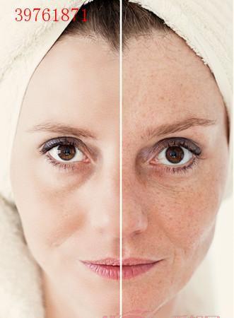 曬斑如何淡化或去掉——美白肌膚的秘訣,曬斑淡化與去除方法,美白肌膚的秘訣