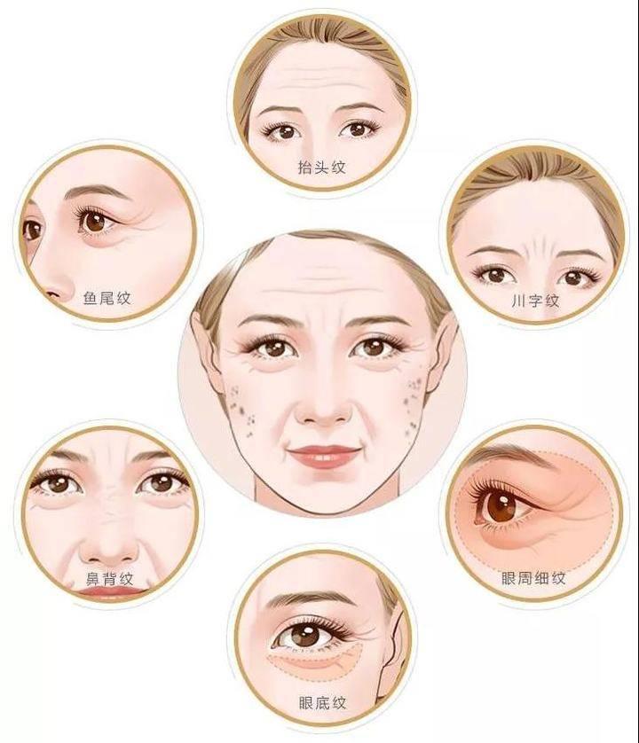 去魚尾紋用什么最好的方法——全面解析抗皺秘訣,去魚尾紋的最佳方法,全面解析抗皺秘訣