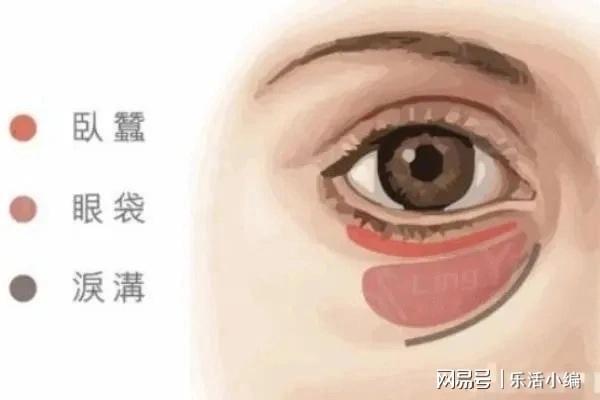 眼袋切除手術費用詳解，價格因素與如何選擇合適的手術方案，眼袋切除手術費用解析，了解價格因素與選擇最佳手術方案